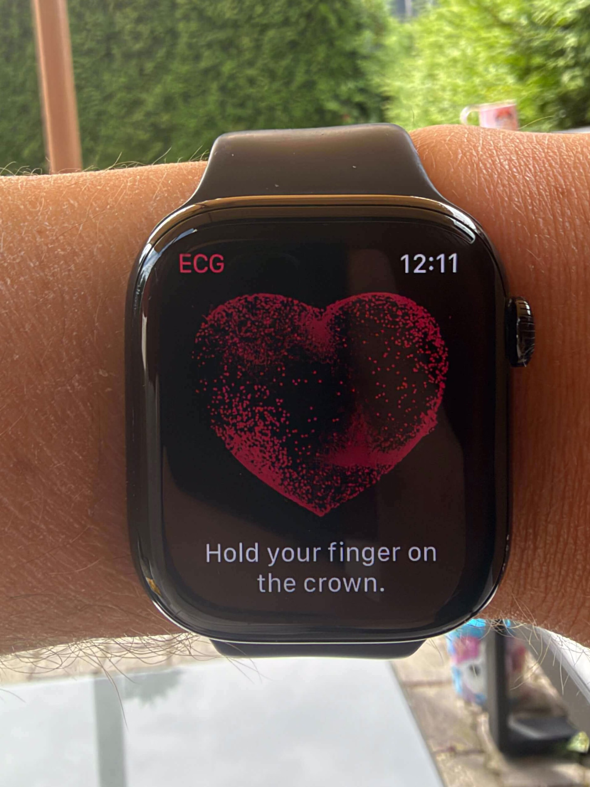 ECG on Apple Watch